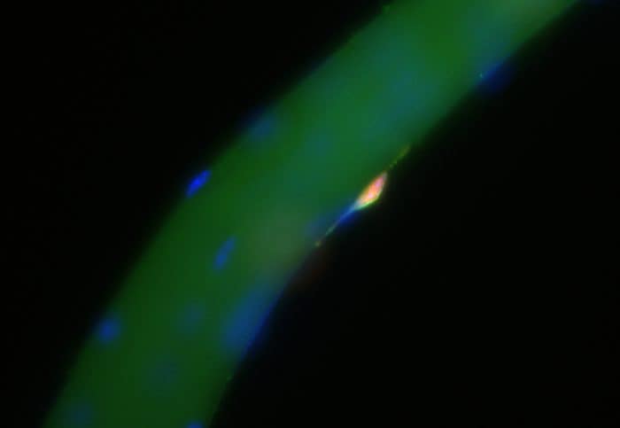 On sait maintenant comment l'acide hyaluronique intervient dans la réparation des dommages musculaires 3 Lorsqu'une fibre musculaire est endommagée, des cellules souches (en rose) commencent à produire et à s'enrober d'acide hyaluronique (contour vert pâle). Une fois que le revêtement devient suffisamment épais, il provoque le réveil des cellules souches musculaires / Kiran Nakka.