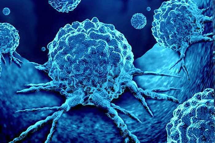 Près de la moitié des décès par cancer sont dus à des facteurs de risque évitables 1 Près De La Moitié Des Décès Par Cancer Sont Dus