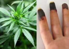 Un Consommateur De Cannabis Développe Des Doigts Bleus Et Des