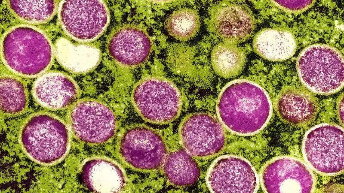 Ce mystérieux virus protège contre la variole du singe 2 Virus monkeypox / NIAID