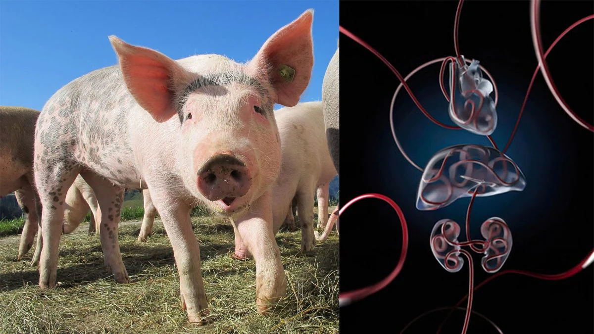 Le rythme cardiaque, la circulation et les fonctions vitales sont restaurés dans les organes des porcs morts depuis une heure 2 À droite, le système de perfusion pour réactiver la circulation et les autres activités cellulaires. Crédit : Université de Yale