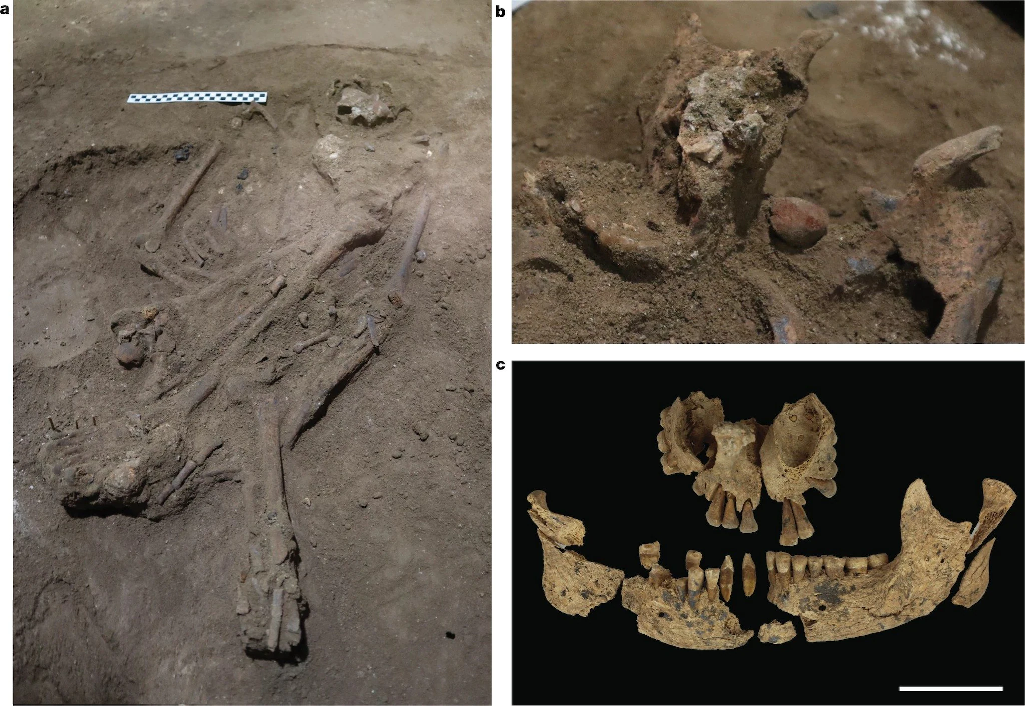 La plus ancienne amputation chirurgicale a été réalisée il y a 31 000 ans : l'histoire de la médecine a été réécrite 3 Crédit : Nature
