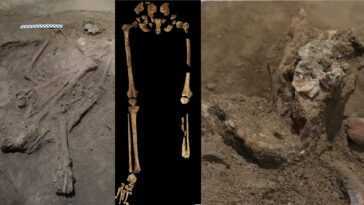 La plus ancienne amputation chirurgicale a été réalisée il y a 31 000 ans : l'histoire de la médecine a été réécrite 5 La Plus Ancienne Amputation Chirurgicale A été Réalisée Il Y