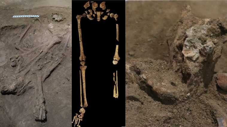 La plus ancienne amputation chirurgicale a été réalisée il y a 31 000 ans : l'histoire de la médecine a été réécrite 1 La Plus Ancienne Amputation Chirurgicale A été Réalisée Il Y
