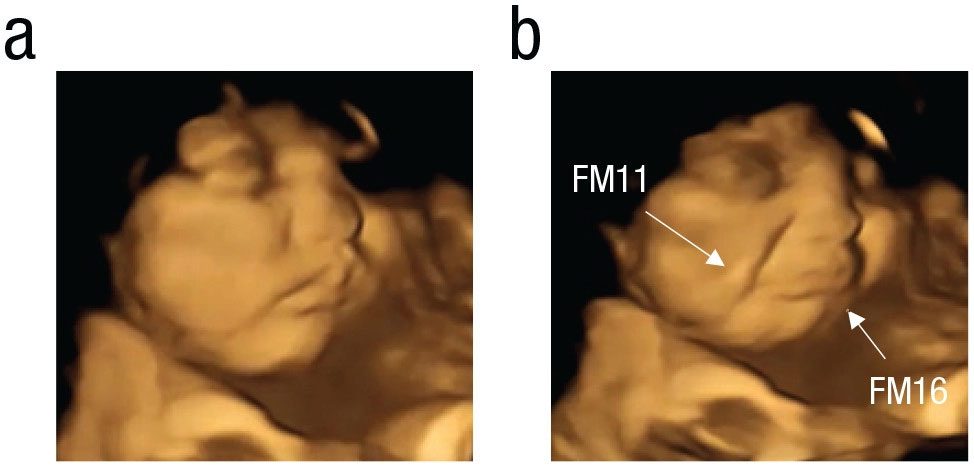 La réaction d'un fœtus au goût du chou / Science psychologique