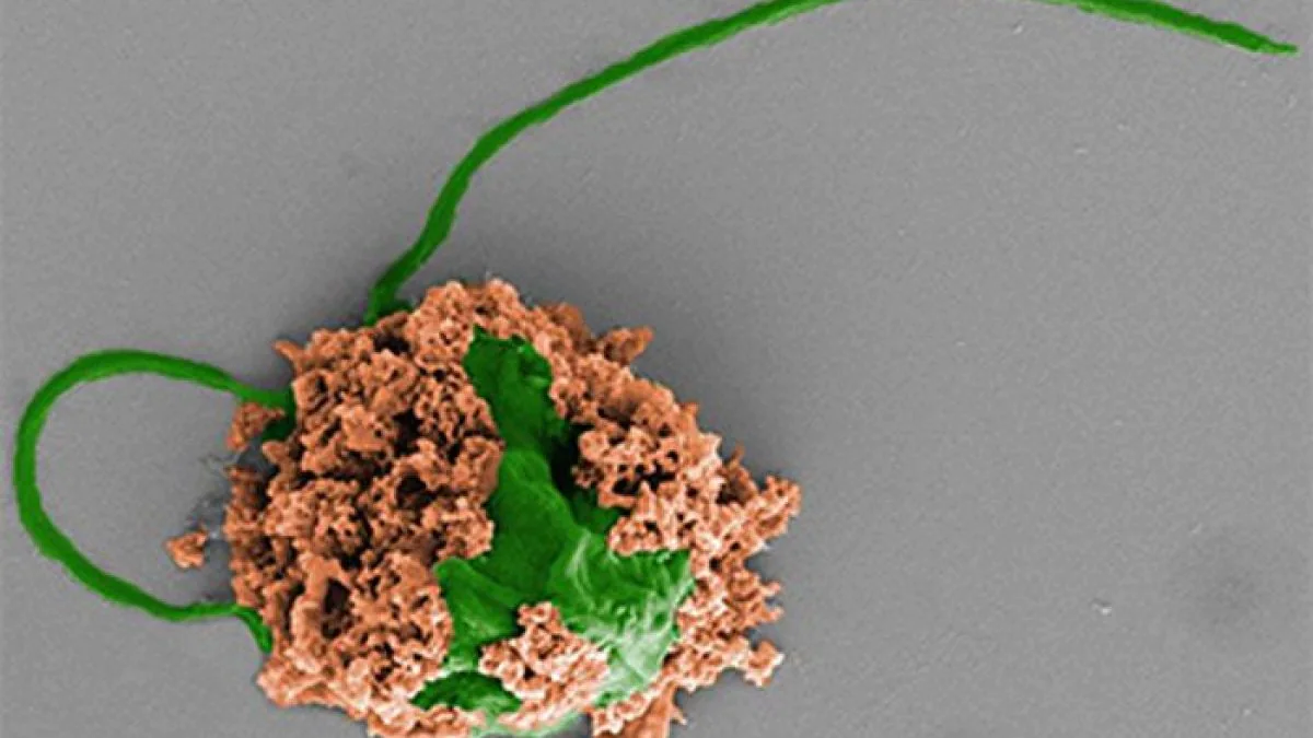 Ces mini robots "nageurs" peuvent éliminer la pneumonie en aussi peu que 3 jours 2 L'un des micro-robots développés par les chercheurs de l'UC San Diego pour lutter contre la pneumonie bactérienne. En vert une cellule d'algue, en marron les nanoparticules chargées d'antibiotiques / UC San Diego