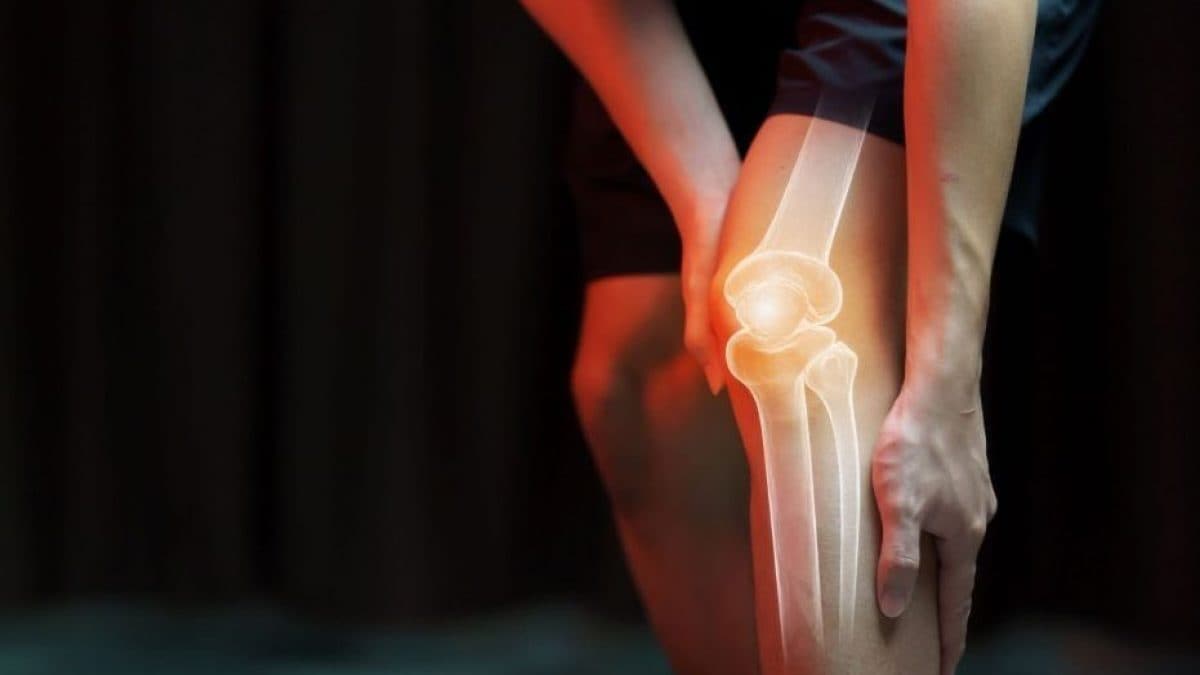 Développée en laboratoire, une "cartilage artificiel" : comment il peut transformer le traitement de l'arthrite 2 Image