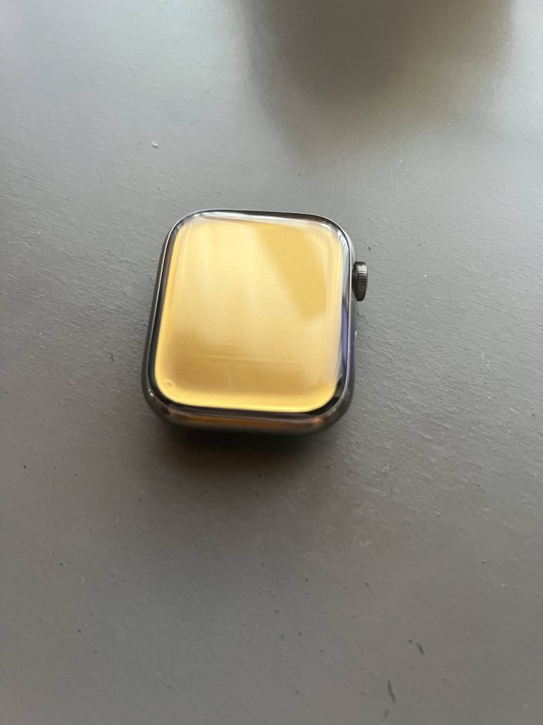 Apple Watch overheats on customer's wrist before blowing up and prompting ER visit 1665003310 345 Apple Watch surchauffe au poignet du client avant dexploser et