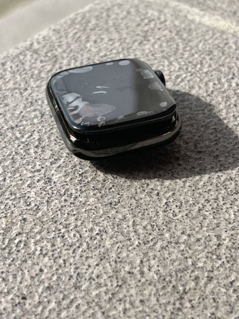 Apple Watch overheats on customer's wrist before blowing up and prompting ER visit 1665003311 703 Apple Watch surchauffe au poignet du client avant dexploser et