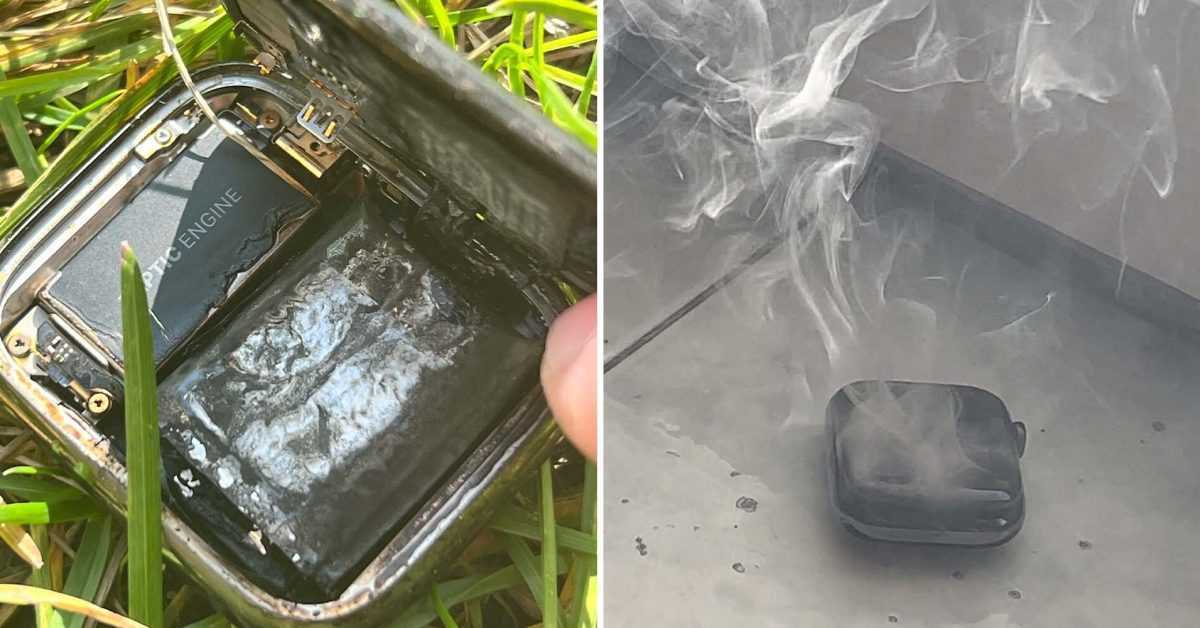 Apple Watch surchauffe au poignet du client avant d'exploser et de provoquer une visite aux urgences
