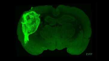 Des Scientifiques Ont Implanté Des Neurones Humains Dans Le Cerveau