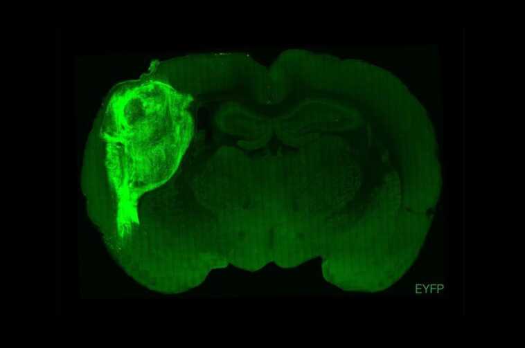 Des scientifiques ont implanté des neurones humains dans le cerveau de rats nouveau-nés : l'étude controversée 1 Des Scientifiques Ont Implanté Des Neurones Humains Dans Le Cerveau