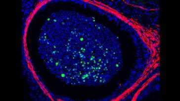 Le virus monkeypox détecté pour la première fois dans les testicules 28 Le Virus Monkeypox Détecté Pour La Première Fois Dans Les