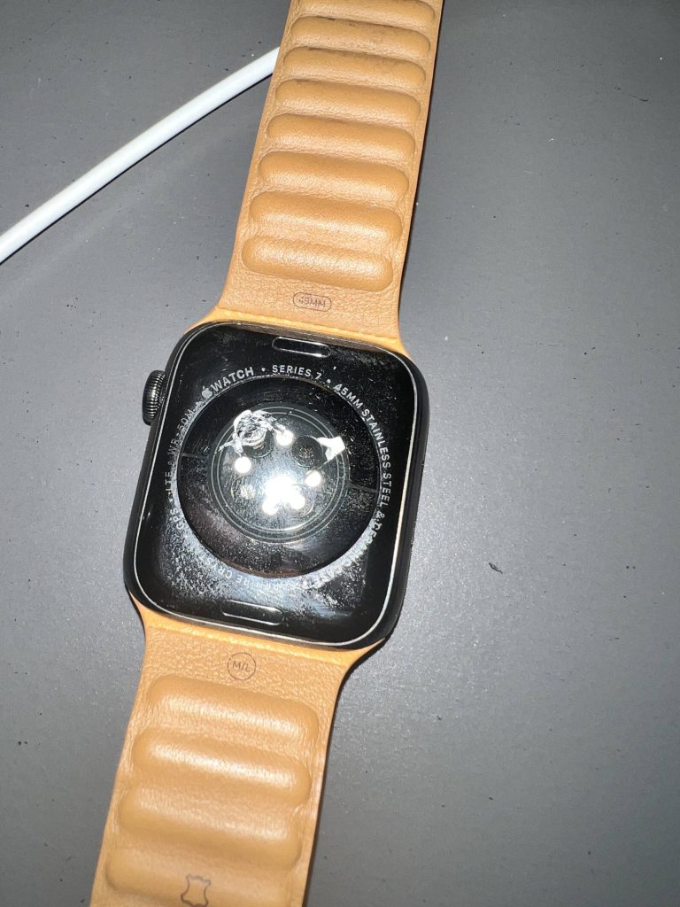 Apple Watch overheats on customer's wrist before blowing up and prompting ER visit Apple Watch surchauffe au poignet du client avant dexploser et