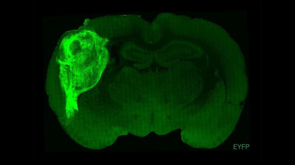 Des scientifiques ont implanté des neurones humains dans le cerveau de rats nouveau-nés : l'étude controversée 2 Dans le tissu cérébral humain vert plus clair dans le cerveau du rat. Crédit : Université de Stanford.