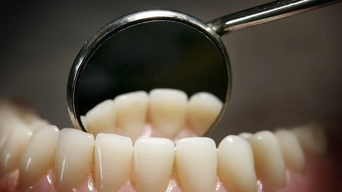 Les fausses dents viennent de Chine et fonctionnent également comme prothèse auditive 2 Les fausses dents viennent de Chine et fonctionnent egalement comme