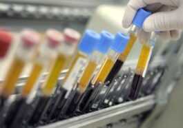 Une Transfusion Révolutionnaire De Sang Cultivé En Laboratoire A été