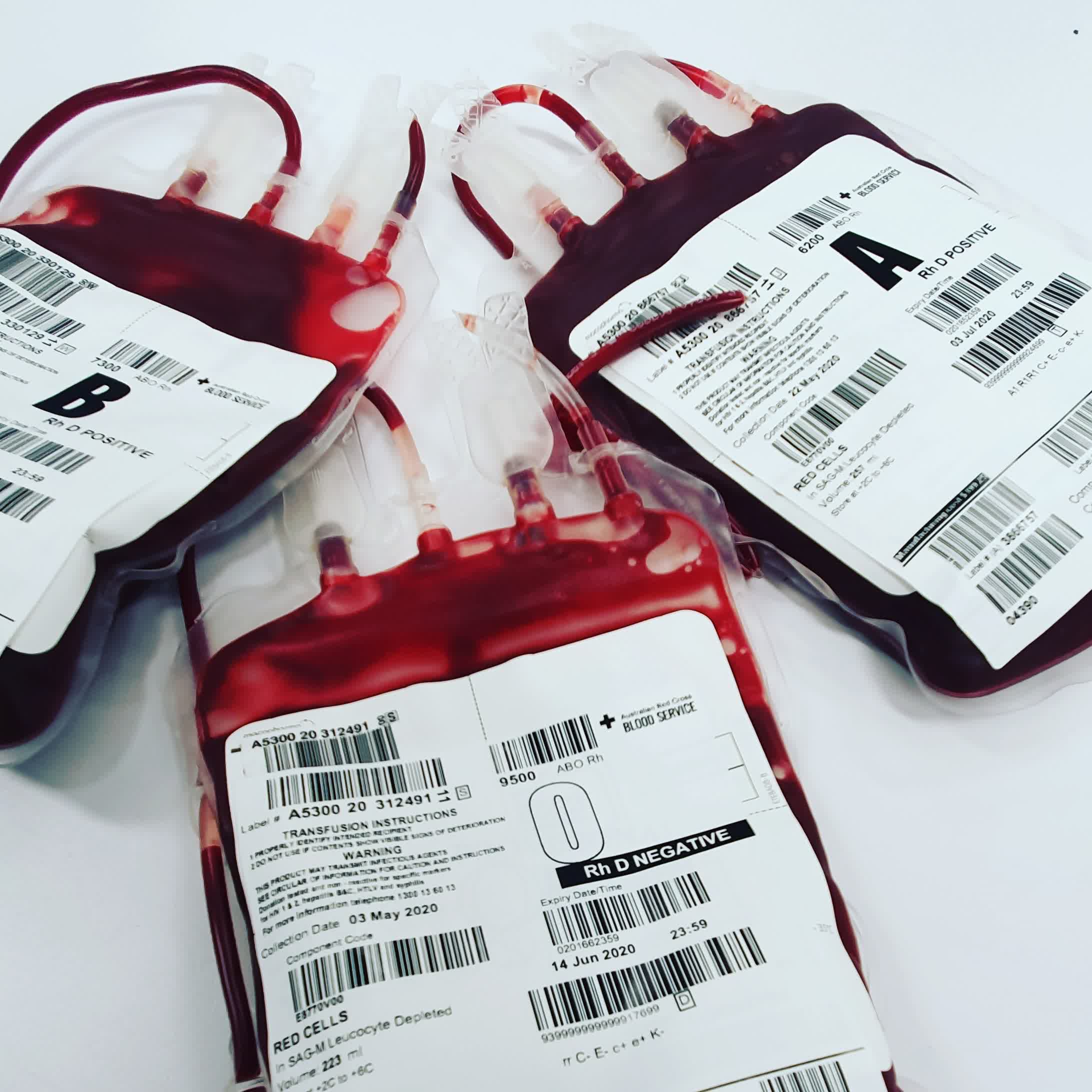 Des essais cliniques britanniques transfusent deux personnes avec du sang produit en laboratoire 3 1667938810 893 Des essais cliniques britanniques transfusent deux personnes avec du sang