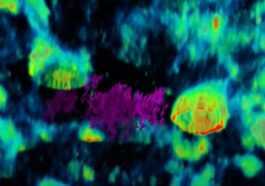 Une vidéo extraordinaire en temps réel montre un virus rôdant entre les cellules humaines 2 Une Vidéo Extraordinaire En Temps Réel Montre Un Virus Rôdant