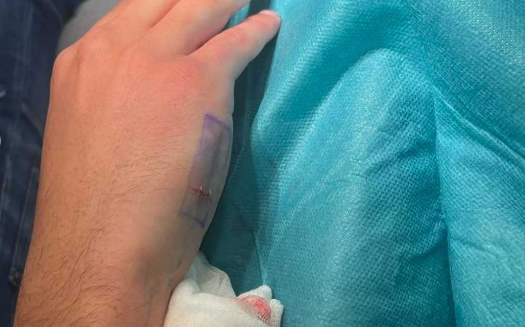Une Puce Sous La Peau Pour Payer En Liquide :