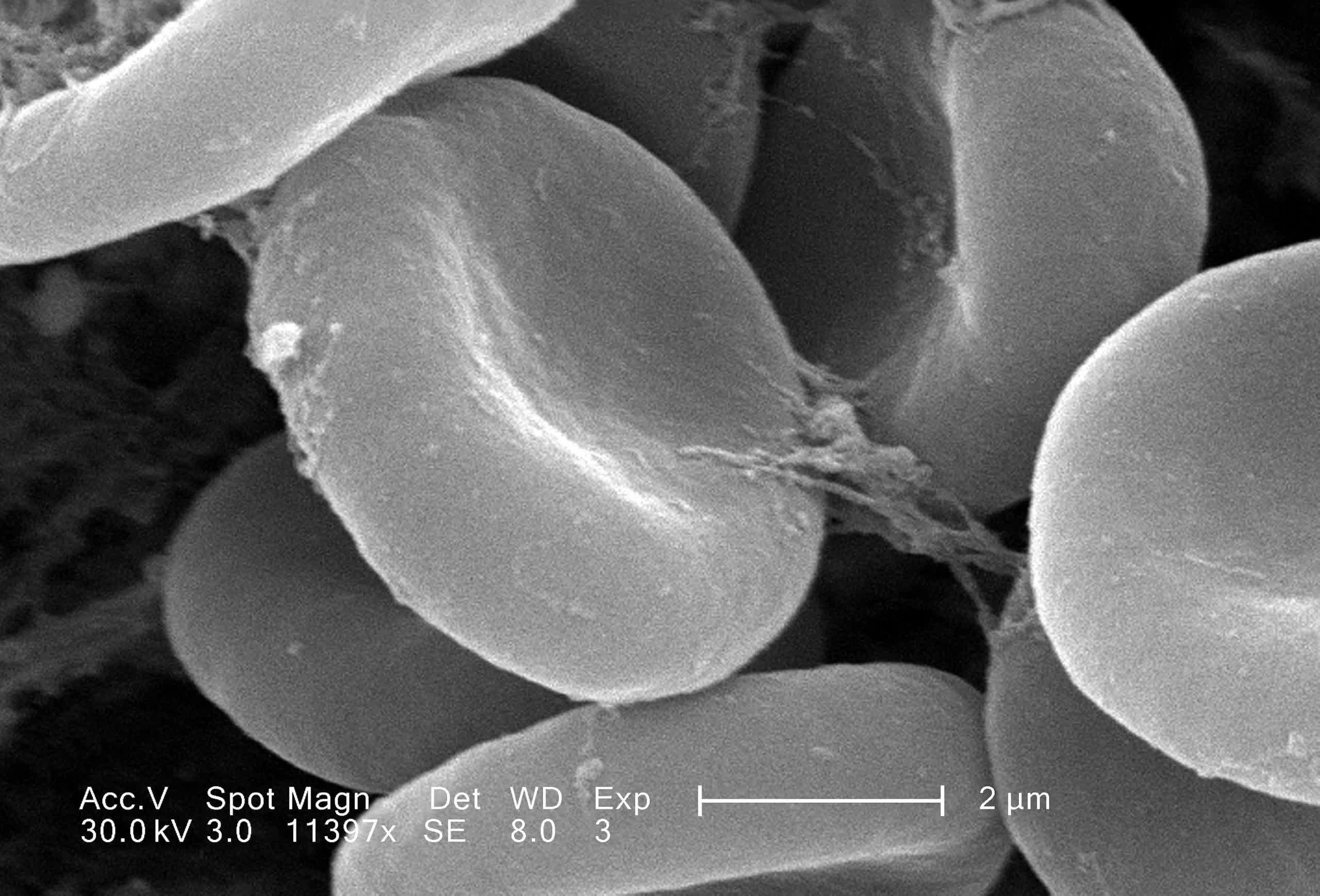 Des essais cliniques britanniques transfusent deux personnes avec du sang produit en laboratoire 2 Des essais cliniques britanniques transfusent deux personnes avec du sang