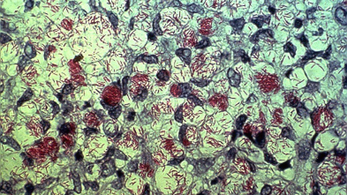 La bactérie de la lèpre pourrait nous aider à percer le plus grand secret du foie 2 Mycobacterium leprae, la bactérie responsable de la lèpre chez l'homme / Wikipédia