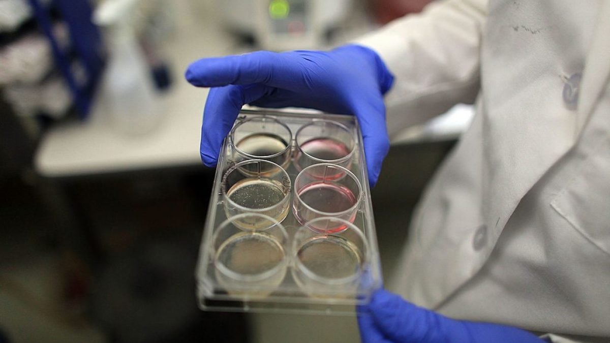 Que sait-on de la superbactérie "Conan" capable de résister et d'éliminer les déchets radioactifs 2 Que sait on de la superbacterie Conan capable de resister et