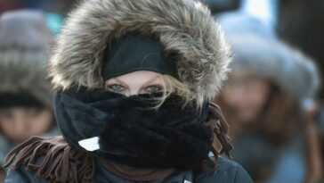 Vous êtes peut-être allergique au froid et ne le savez pas : quels sont les symptômes à surveiller 10 Vous êtes Peut être Allergique Au Froid Et Ne Le Savez