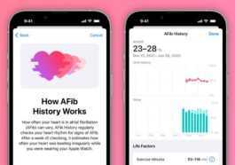 La mise à jour watchOS 9.2 étend la fonction d'historique AFib sur Apple Watch à un autre pays