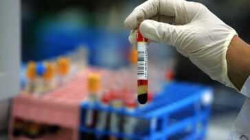 Une seule hormone peut prédire les futurs problèmes de santé chez les hommes 8 Une Seule Hormone Peut Prédire Les Futurs Problèmes De Santé