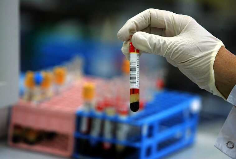 Une seule hormone peut prédire les futurs problèmes de santé chez les hommes 1 Une Seule Hormone Peut Prédire Les Futurs Problèmes De Santé