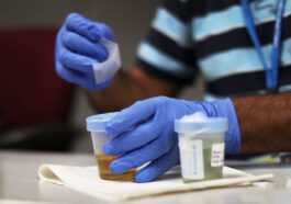 Un appareil révolutionnaire détecte le cancer dans l'urine : percée pour un diagnostic précoce