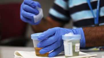Un appareil révolutionnaire détecte le cancer dans l'urine : percée pour un diagnostic précoce 28 Un appareil révolutionnaire détecte le cancer dans l'urine : percée pour un diagnostic précoce