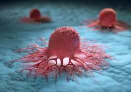 Breakthrough ecDNA discovery could revolutionize cancer research