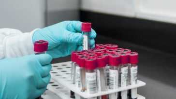 Un homme de 53 ans est complètement guéri du VIH : c'est l'un des très rares cas au monde 28 Un homme de 53 ans est complètement guéri du VIH : c'est l'un des très rares cas au monde
