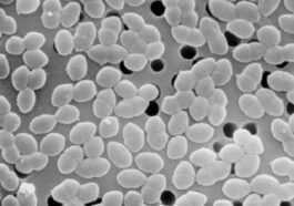 Nous savons peut-être pourquoi certaines bactéries sont devenues résistantes même au dernier antibiotique efficace