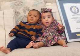 Deux bébés canadiens sont devenus les jumeaux les plus prématurés au monde