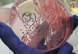 Il semble y avoir un moyen de combattre les bactéries résistantes sans utiliser d'antibiotiques