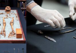 Médecin de la Rome antique enterré avec des scalpels, des aiguilles et des pincettes : découverte archéologique extraordinaire