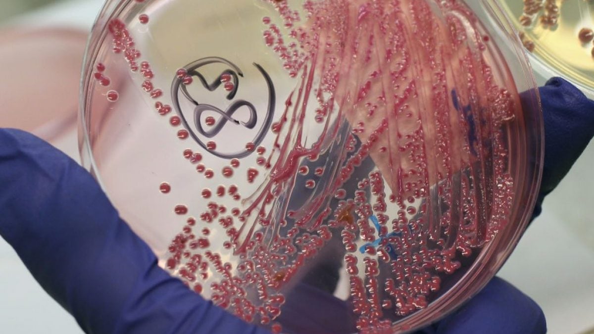 Il semble y avoir un moyen de combattre les bactéries résistantes sans utiliser d'antibiotiques 2 Il semble y avoir un moyen de combattre les bacteries