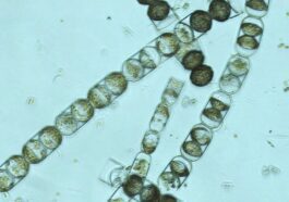 Algues arctiques pleines de microplastiques : nous avons pollué toute la planète