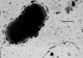 La maladie de Parkinson pourrait être causée par une bactérie aquatique