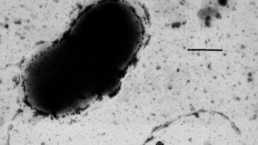 La maladie de Parkinson pourrait être causée par une bactérie aquatique 13 La maladie de Parkinson pourrait être causée par une bactérie aquatique