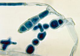 Premiers cas de teigne sévère résistante aux antibiotiques aux USA : quels sont les risques ?