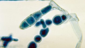Premiers cas de teigne sévère résistante aux antibiotiques aux USA : quels sont les risques ?