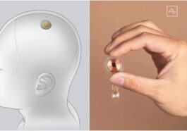 Elon Musk va tester ses puces Neuralink dans le cerveau humain : à quoi sert l'implant et comment ça marche