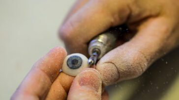 Des scientifiques testent des prothèses oculaires imprimées en 3D sur des patients en Australie 2 Scientists are testing 3D-printed prosthetic eyes with patients in Australia
