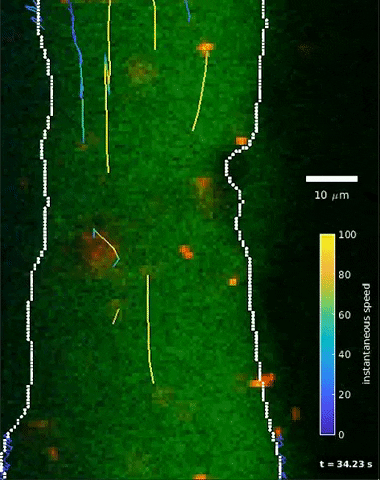 L'intelligence artificielle nous montre comment circulent les fluides cérébraux 3 L'espace périvasculaire (zone à l'intérieur des lignes blanches) où les chercheurs ont injecté de minuscules particules. Ces particules (représentées par des points mobiles) sont suivies de lignes indiquant leur direction. Après avoir mesuré la position et la vitesse de la particule au fil du temps, l'équipe a ensuite intégré cette vidéo 2D à des réseaux de neurones basés sur la physique pour créer des images 3D haute résolution du système fluide du cerveau / Crédit : Douglas Kelly