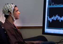 Huawei Brain-computer interface