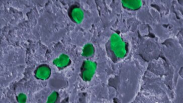Les scientifiques ont une idée folle pour produire de l'oxygène sur Mars 22 Imagem de bactéria que poderá produzir oxigénio em Marte incorporada numa tinta biológica